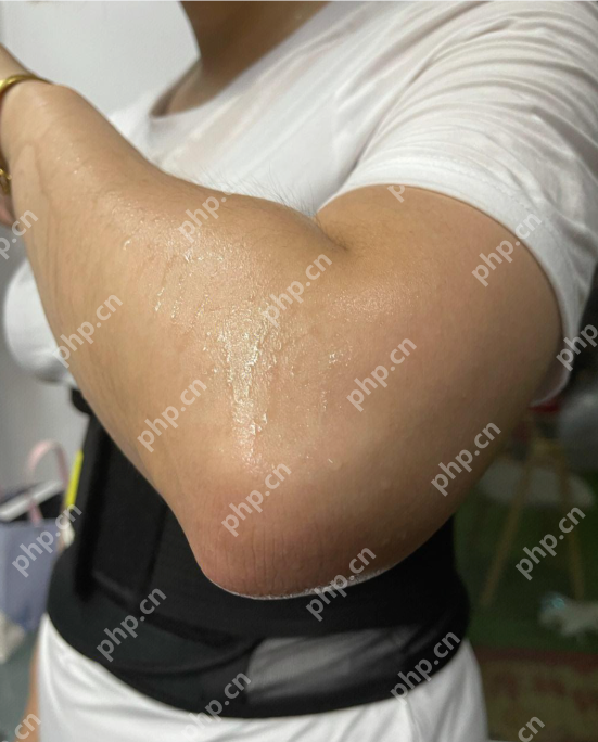 这4个常被误解的“身体缺陷”，其实是健康的标志 - php中文网