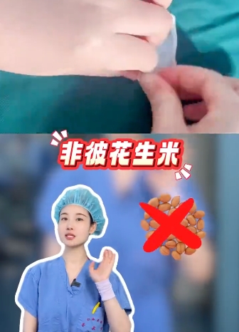 手术室为什么要用花生米 花生米起什么作用