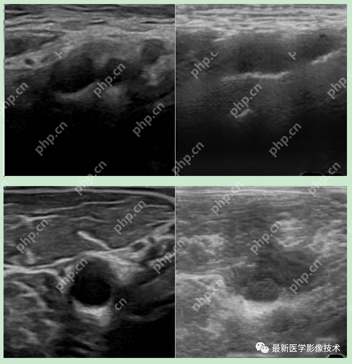 USenhance2023——2023 年超声图像增强挑战赛